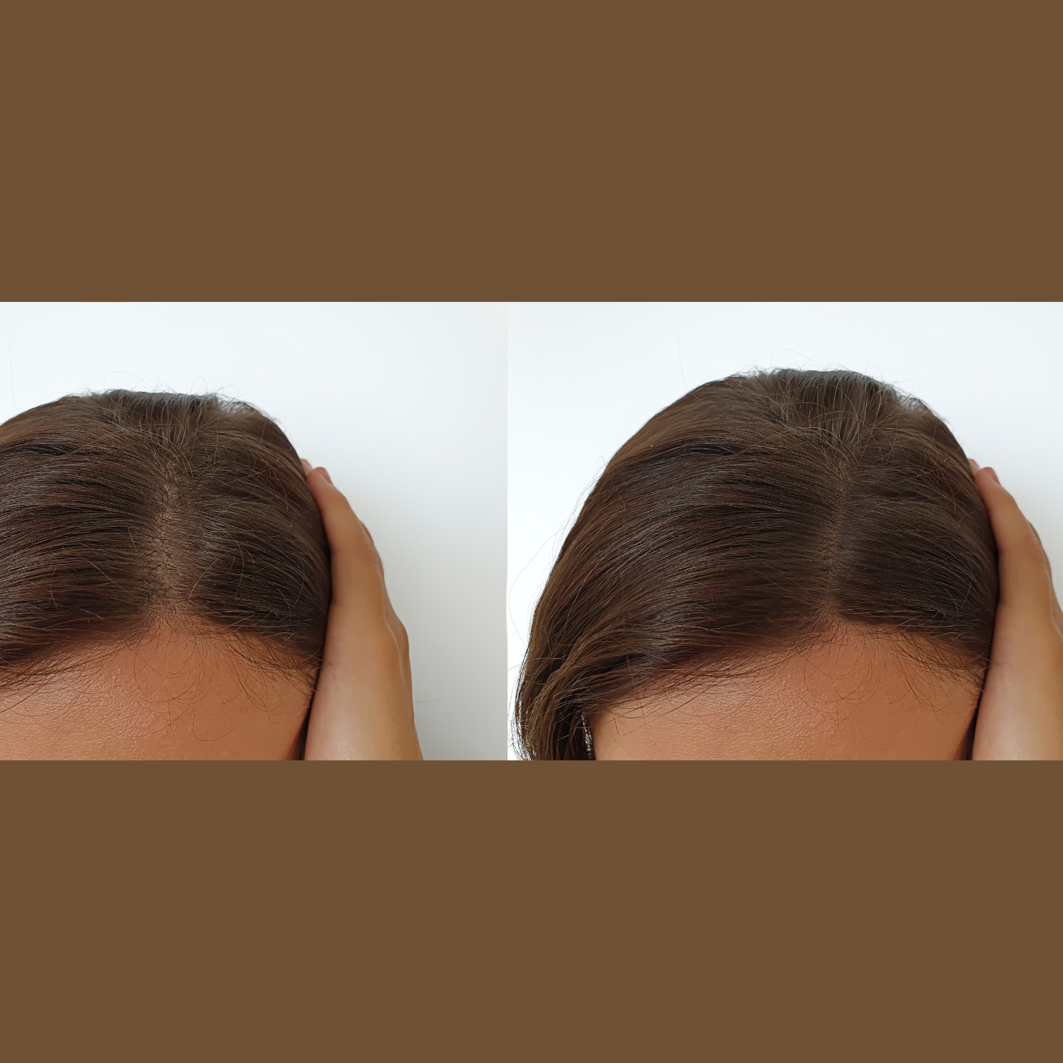 Hair Growth Trio Bundle | ⭐️ 87% experienced visible hair growth in 45 days|Save 1712.7 Rupees